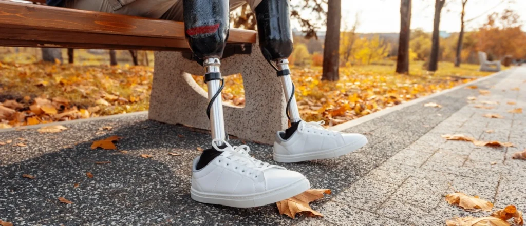 Limb Salvage with Megaprosthesis