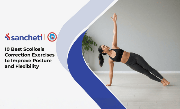 10 Best Scoliosis Correction Exercises to Improve Posture and Flexibility