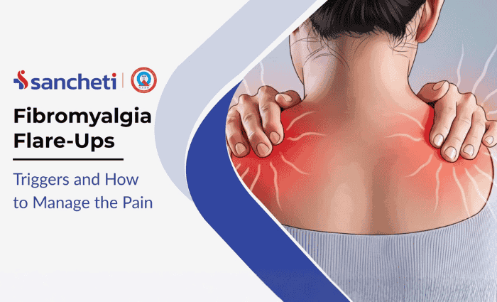 Fibromyalgia Flare-ups