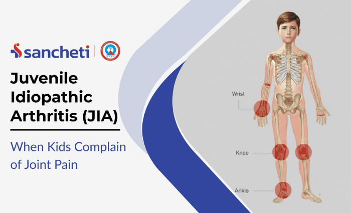 Juvenile Idiopathic Arthritis
