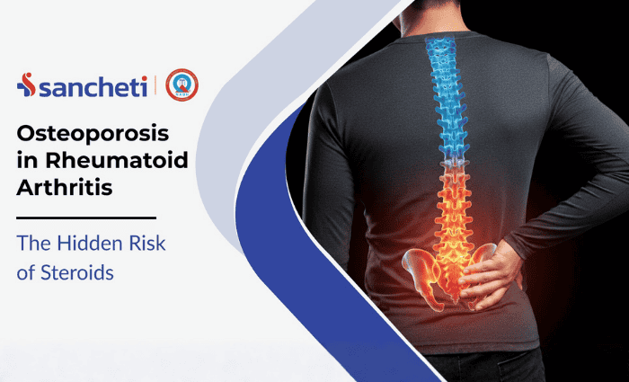 Osteoporosis in rheumatoid
