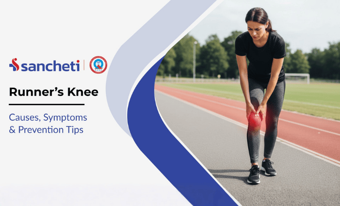 Runner's Knee causes, symptoms and treatment
