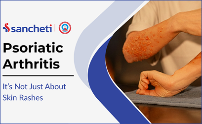 Sancheti Badminton League 2026 (SBL)