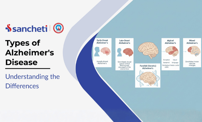 Types of Alzheimer Disease