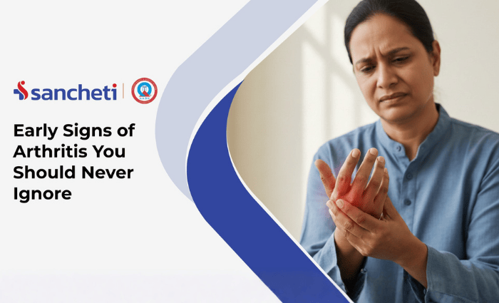 Early Signs of Arthritis You Should Never Ignore