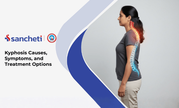 Kyphosis Causes, Symptoms, and Treatment Options