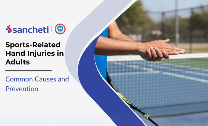 Sports-Related Hand Injuries in Adults Common Causes and Prevention