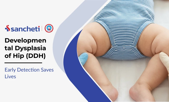 Developmental Dysplasia of Hip (DDH): Early Detection Saves Lives 3 Developmental Dysplasia of Hip (DDH)_ Early Detection Saves Lives