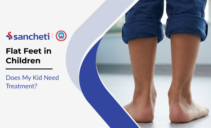 Flat Feet in Children: Does My Kid Need Treatment? 6 Flat Feet in Children Does My Kid Need Treatment