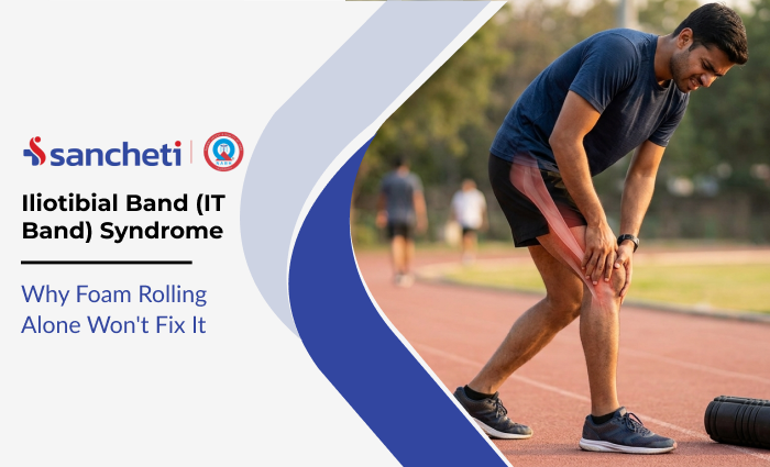 Iliotibial Band (IT Band) Syndrome: Why Foam Rolling Alone Won't Fix It 4 Iliotibial Band (IT Band) Syndrome