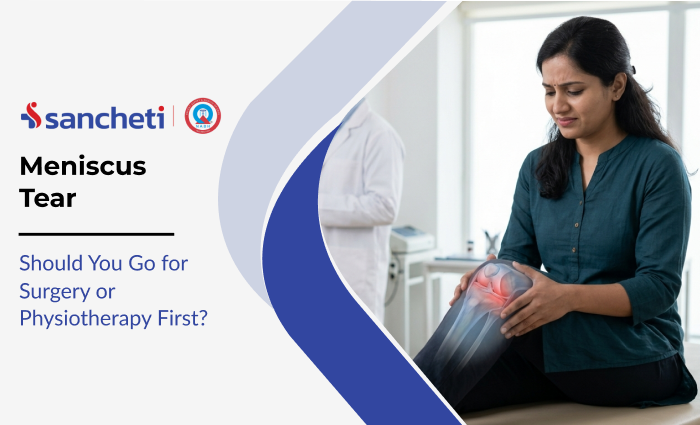 Meniscus Tear: Should You Go for Surgery or Physiotherapy First? 10 Meniscus Tear