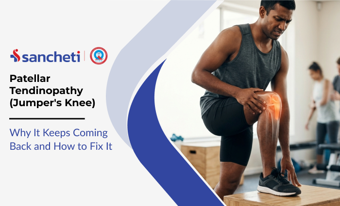 Patellar Tendinopathy (Jumper's Knee): Why It Keeps Coming Back and How to Fix It 8 Patellar Tendinopathy (Jumper's Knee)