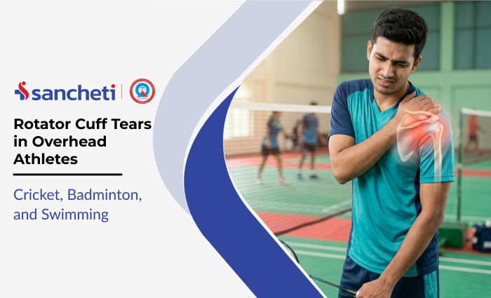 Rotator Cuff Tears in Overhead Athletes: Cricket, Badminton, and Swimming 10 Rotator Cuff Tears in Overhead Athletes
