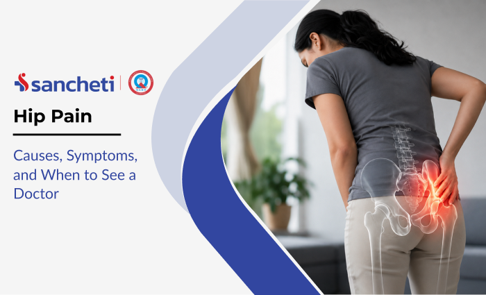 Hip Pain: Causes, Symptoms, and When to See a Doctor 2 hip_pain_causes_symptoms_and_when_to_see_a_doctor