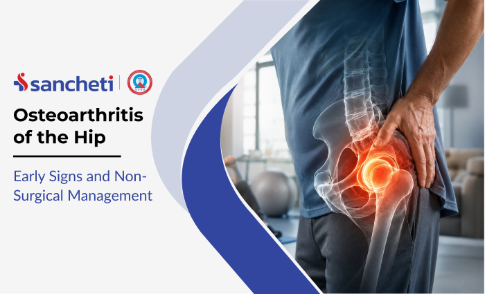 Osteoarthritis of the Hip: Early Signs and Non-Surgical Management 4 osteoarthritis_of_the_hip_early_signs_and_non_surgical_management
