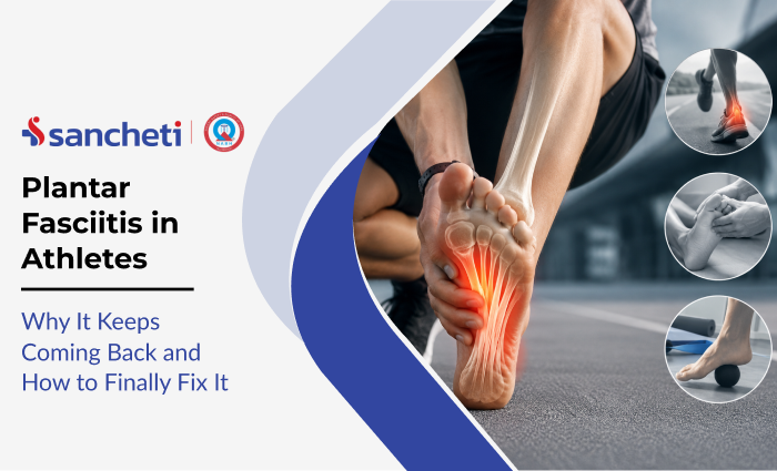 plantar_fasciitis_in_athletes_why_it_keeps_coming_back_and_how_to_finally_fix_it