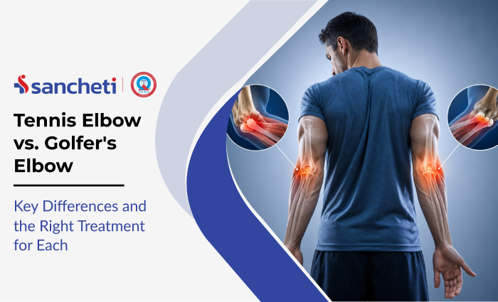 tennis_elbow_vs_golfer_s_elbow_key_differences_and_the_right_treatment_for_each