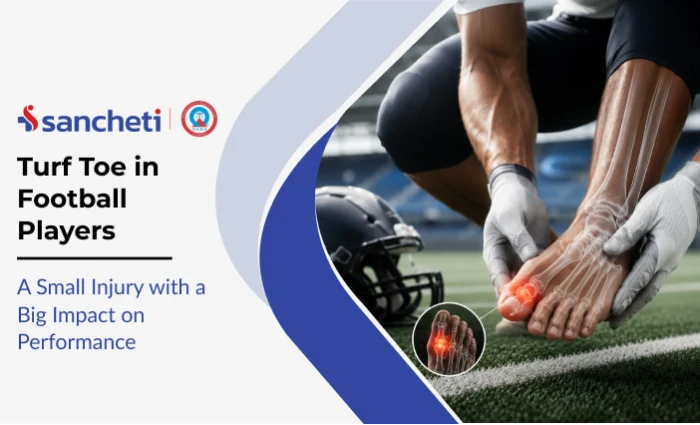 turf_toe_in_football_players