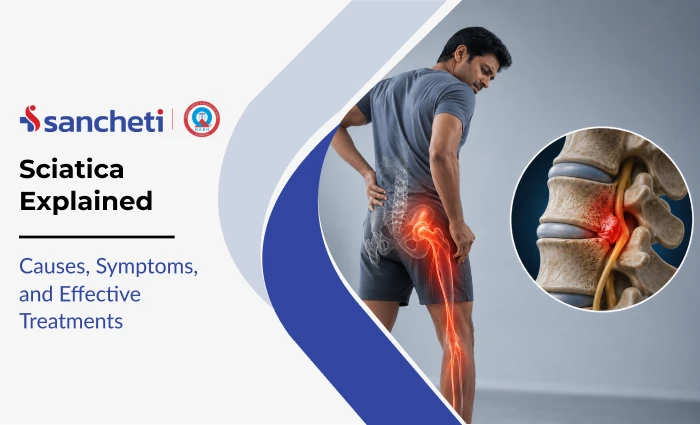 sciatica_explained_1x (1)