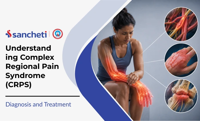 understanding_complex_regional_pain_syndrome_crps__1x (1)
