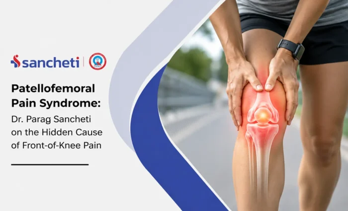 Patellofemoral Pain Syndrome Dr. Parag Sancheti on the Hidden Cause of Front-of-Knee Pain