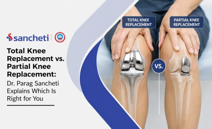Total Knee Replacement vs. Partial Knee Replacement